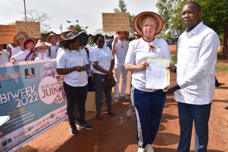 ALBIWEEK : un mémorandum remis à la CNDH pour plaider la cause des personnes albinos